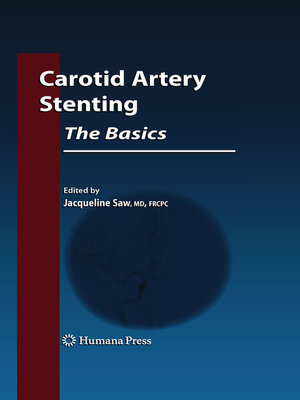 cover image of Carotid Artery Stenting